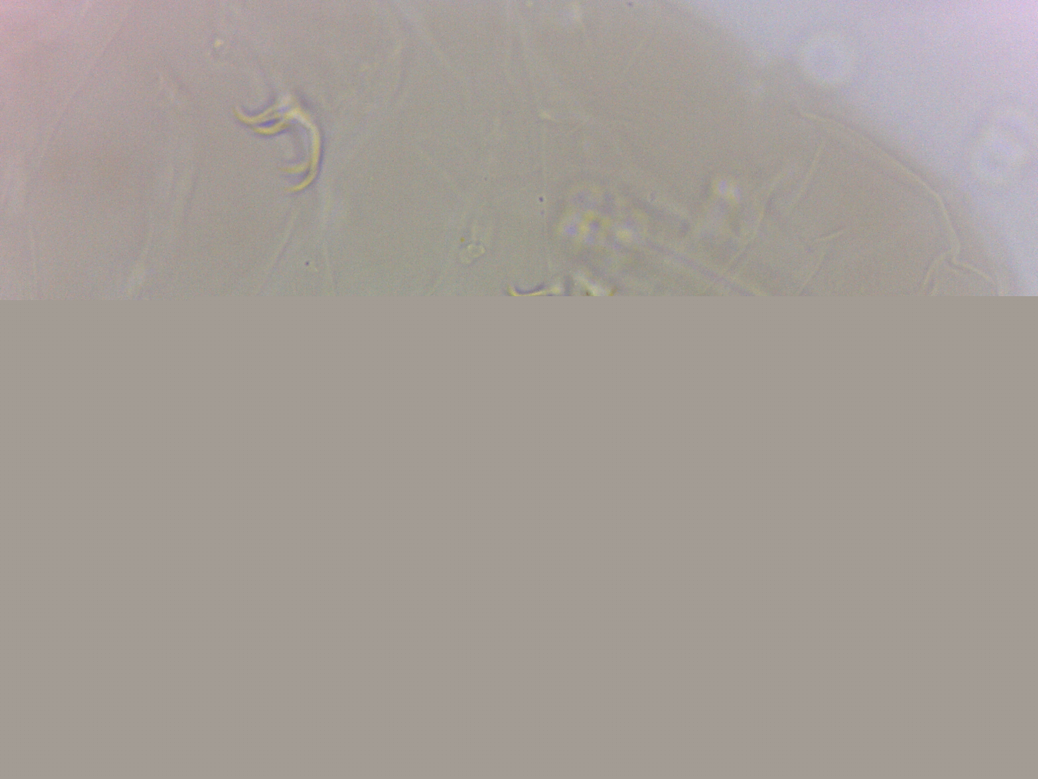 Doryphoribius zappalai image