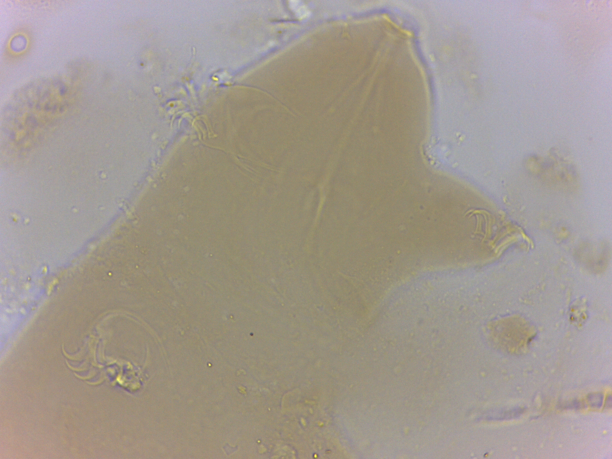 Echiniscoides sigismundi image