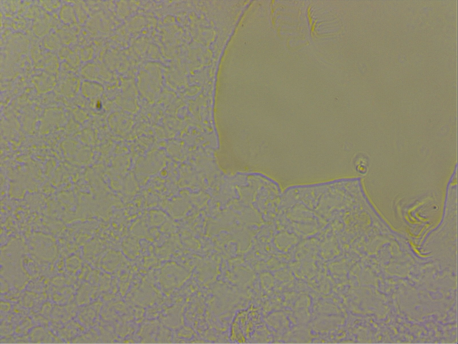 Echiniscoides sigismundi image