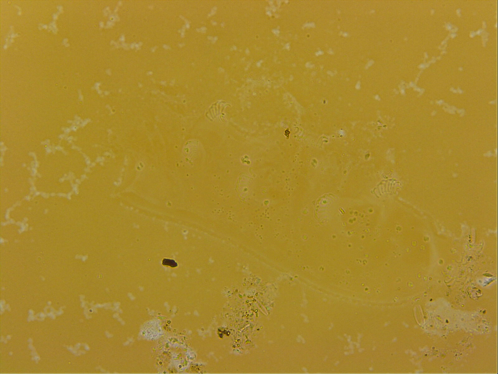 Echiniscoides sigismundi image