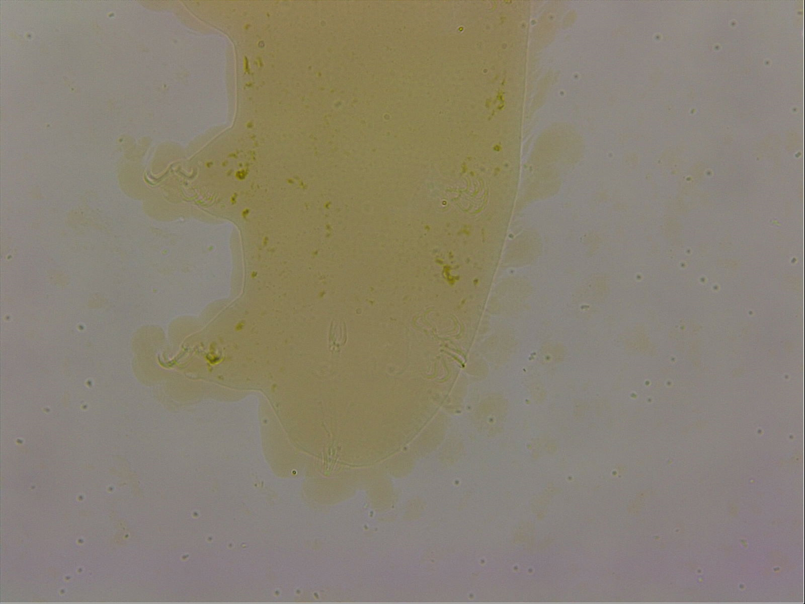 Echiniscoides sigismundi image