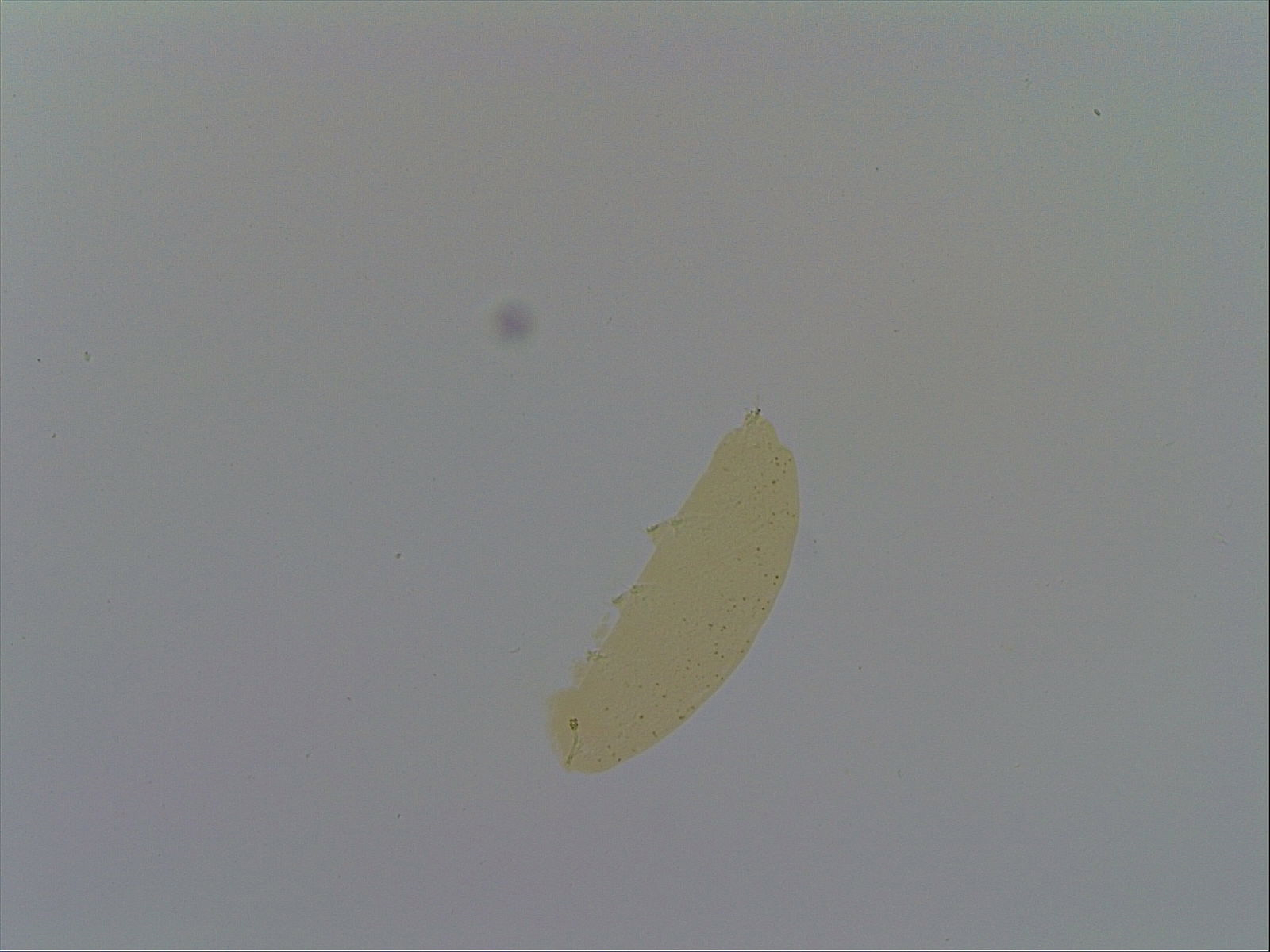 Hypsibius calcaratus image