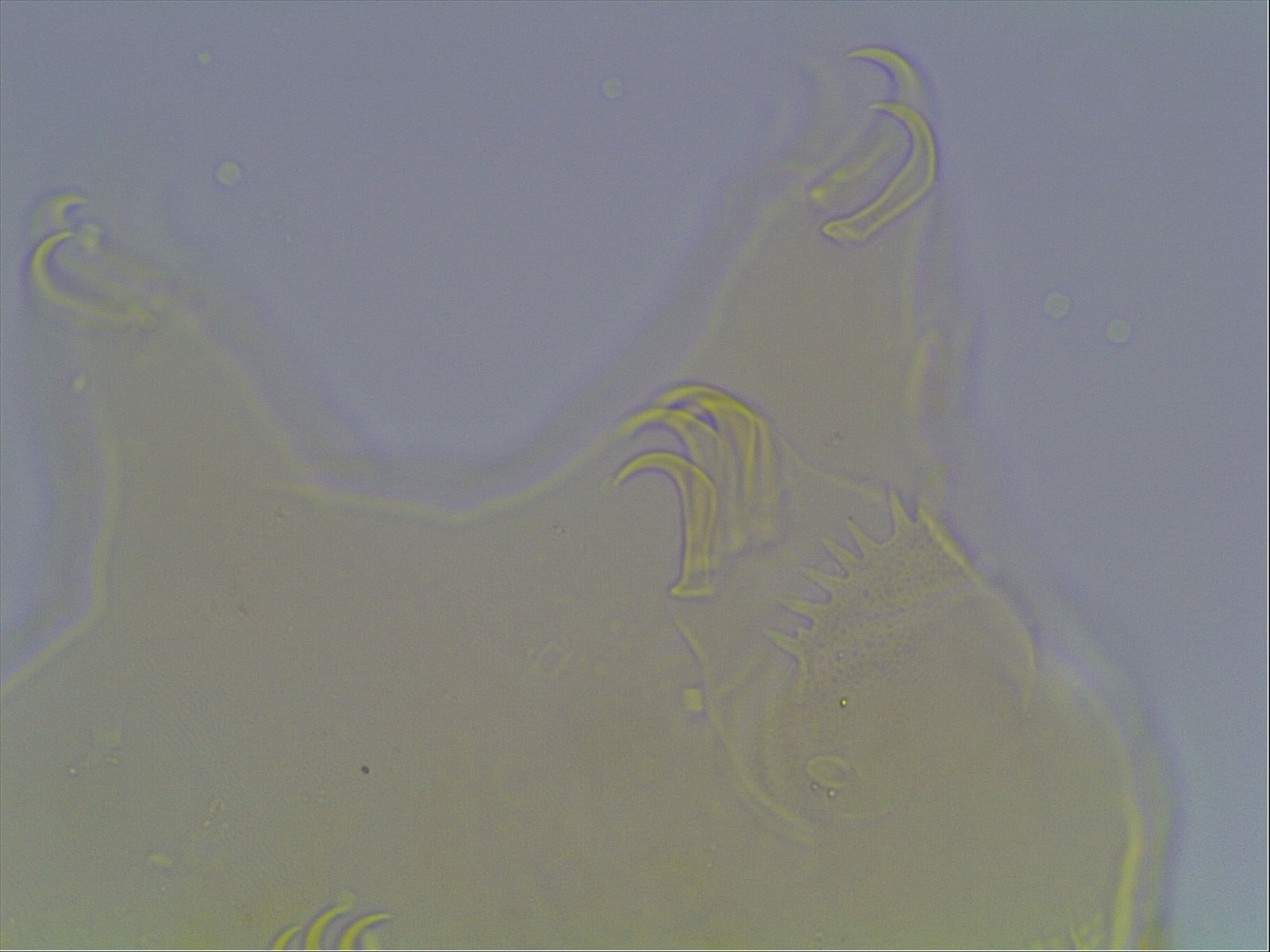 Echiniscus baius image