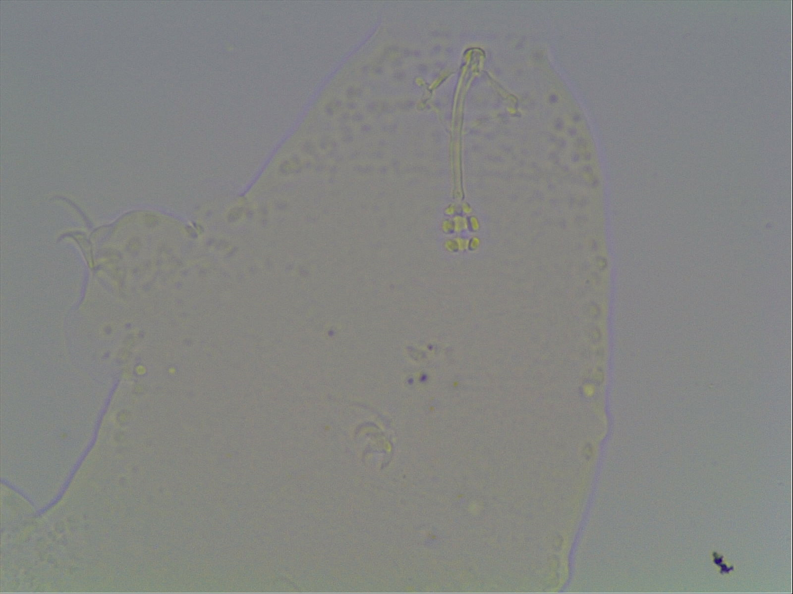 Hypsibius calcaratus image
