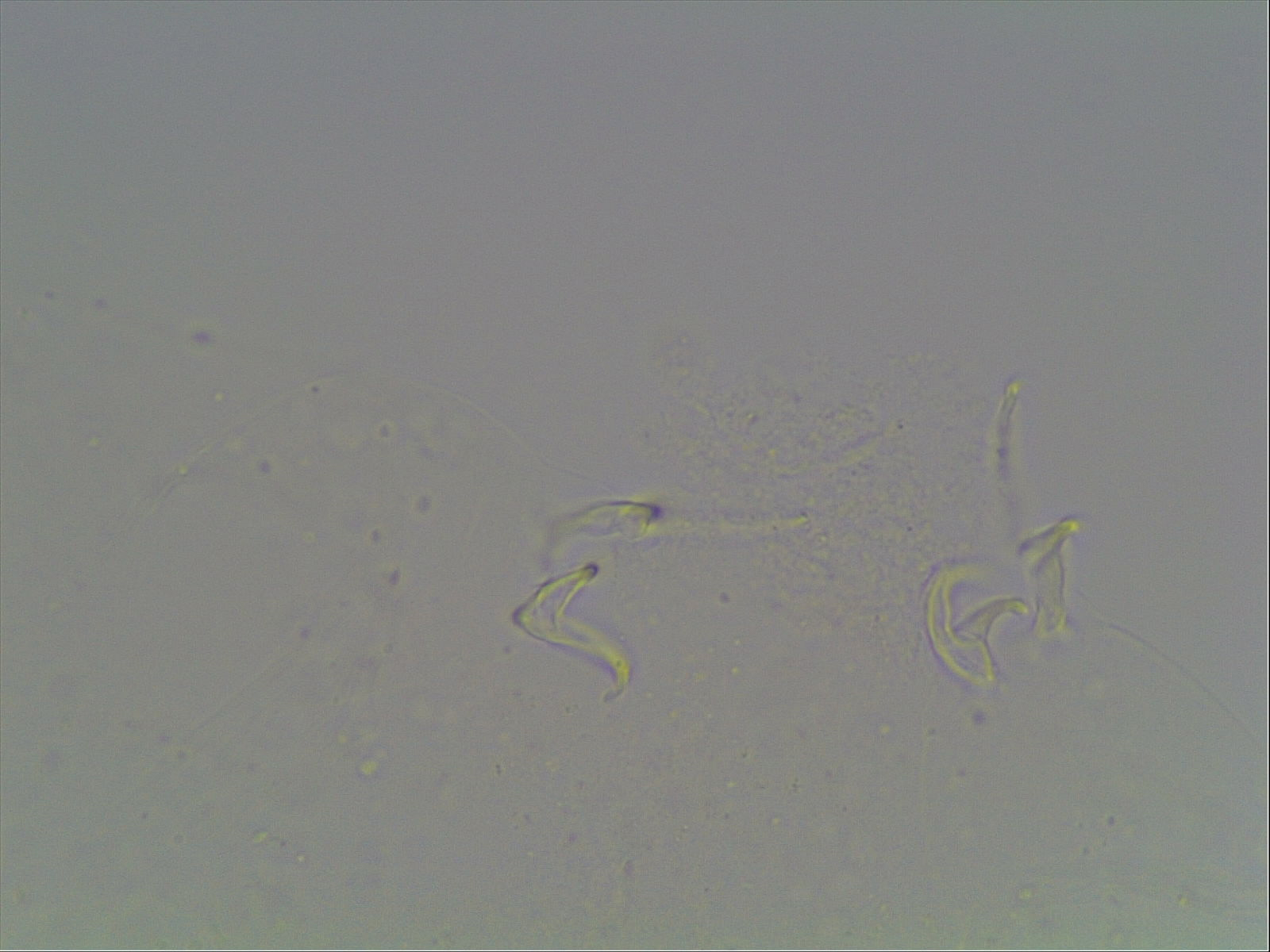 Hypsibius calcaratus image