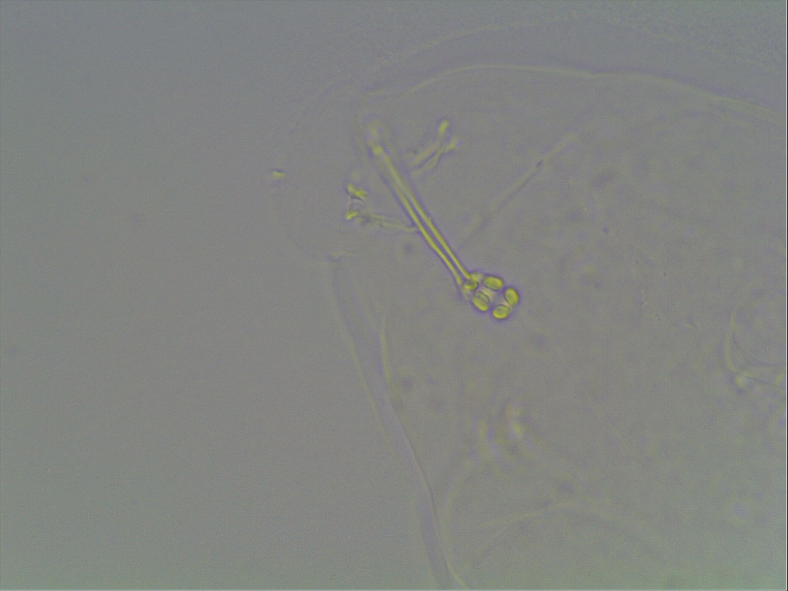Hypsibius calcaratus image