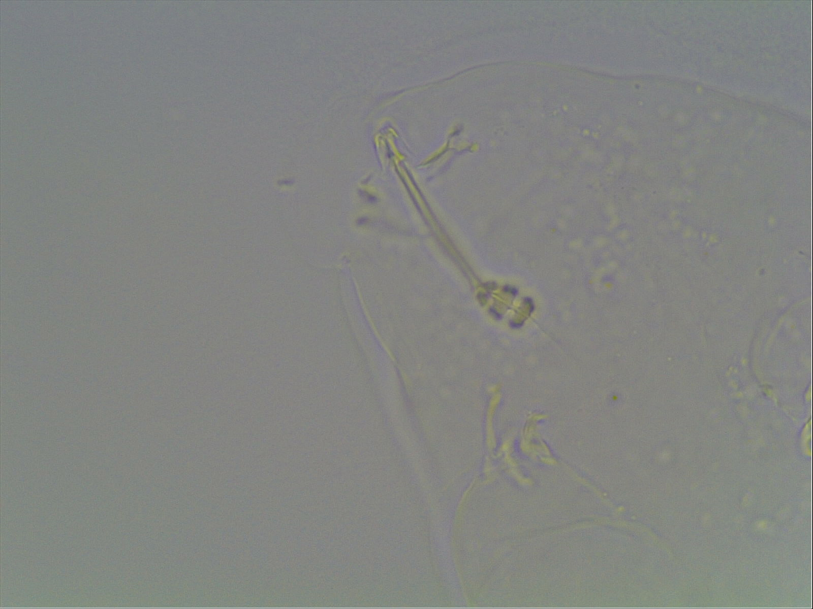 Hypsibius calcaratus image