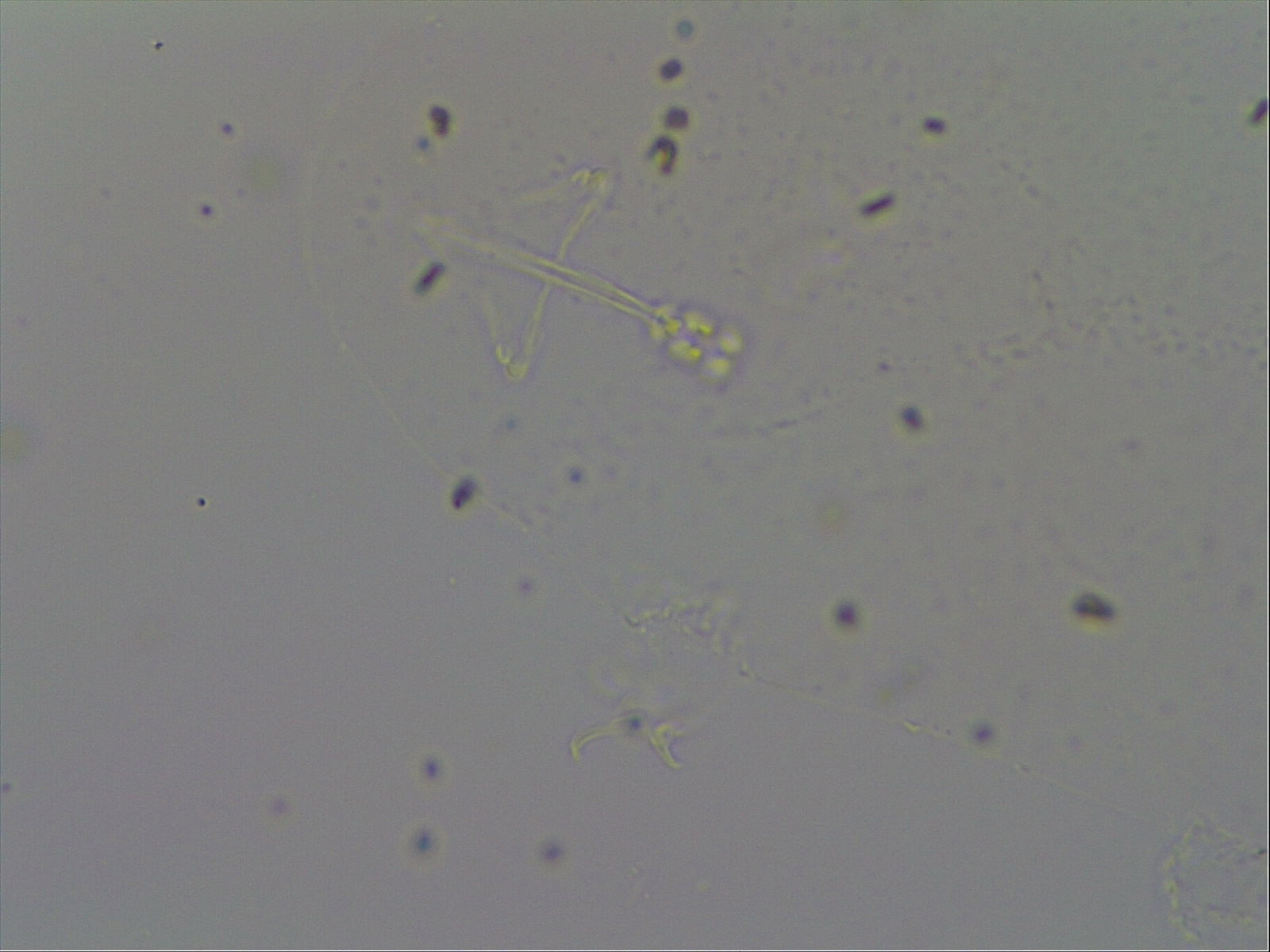 Hypsibius calcaratus image
