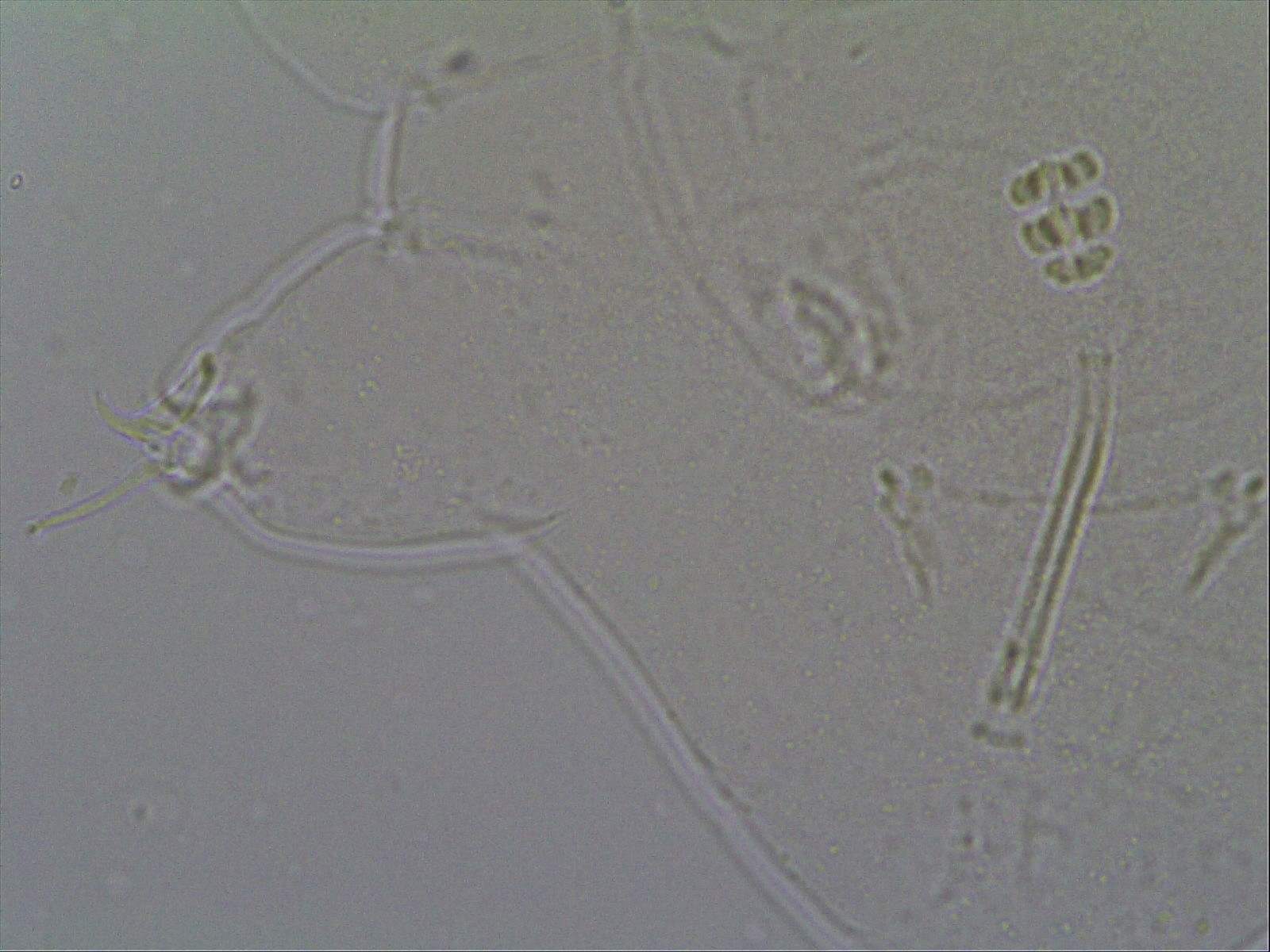 Hypsibius calcaratus image