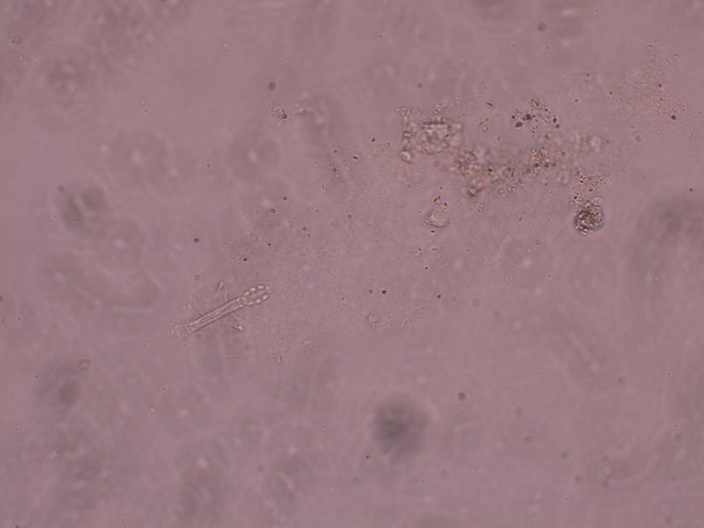 Schusterius tridigitus image