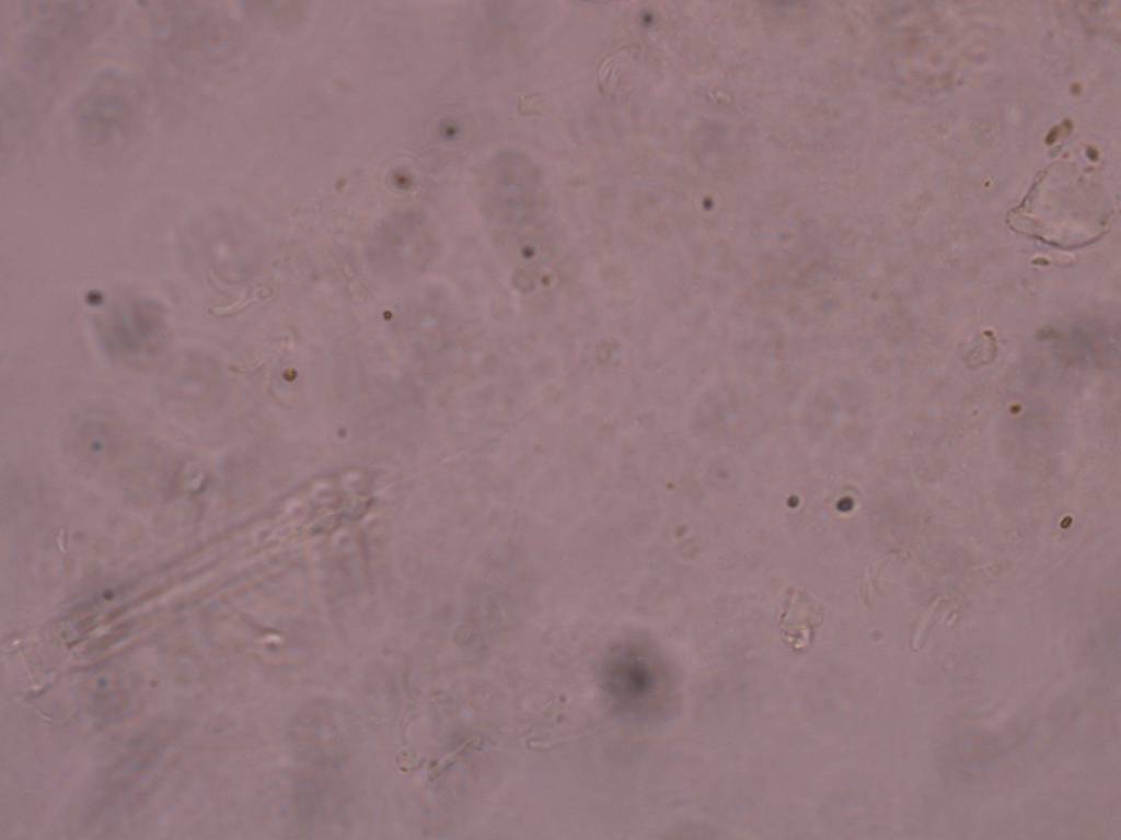 Schusterius tridigitus image