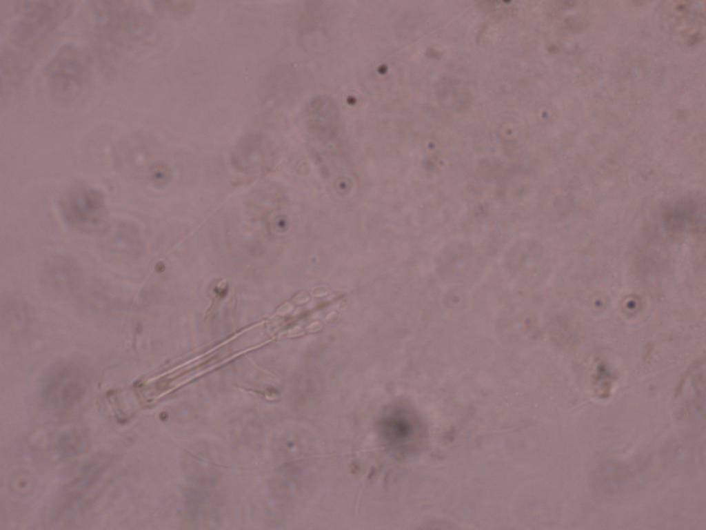 Schusterius tridigitus image