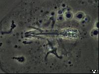 Isohypsibius condorcanquii image