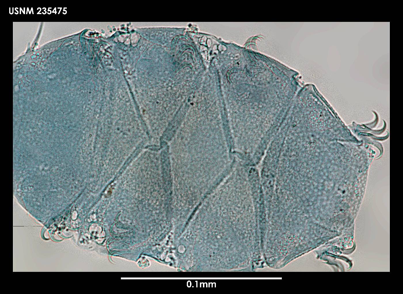 Echiniscus capillatus image